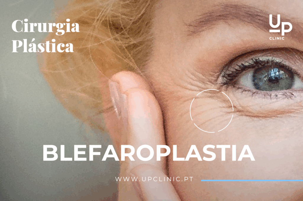 blefaroplastia